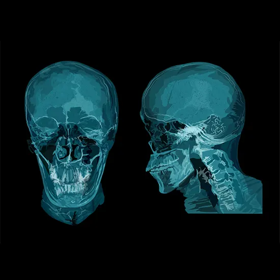 What Is The Role Of X-Rays Of The Skull?